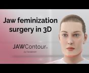 Facialteam — Facial Feminization Surgery