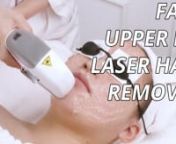 EASY! How To: Upper Lip Laser HAIR Removal! *Painless* Face IPL Laser Hair Removal myChway TX001nn❤️Check the price：https://www.mychway.com/itm/1002325.htmlnIn this video, I will show how to remove the upper lip hair, face hair by the ipl hair removal laser machine, BTW, I&#39;ll record the whole hair removal procedure nn❤️How Does The Laser Hair Removal work?nThe main function of IPL hair removal technology is to remove hair on all parts of the body and face. Its working principle is to u