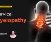 Among the variety of Neck Deformities, the incidence of cervical myelopathy is high in older individuals. All the details about Cervical Myelopathy, ranging from its definition to cervical myelopathy causes and symptoms are discussed in this lecture of orthopaedics for medical students. Alongside, ossification of posterior longitudinal ligament is made understandable.nn-------------------------------------------------------------nLecture Duration - 00:48:58nRelease Date - January 2020nnWatch com