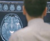 This patient information video explains the process of having a MRI scan at Melbourne Radiology Clinic.This particular MRI is known as a Wide Bore Magnetic Resonance Imaging (MRI) Scanner.nMelbourne Radiology Clinic&#39;s MRI scanner is the latest Siemens Espree unit which has a wide bore that is 16% larger than conventional MRI units and is ideal for claustrophobic and large patients. Even non-claustrophobic patients, benefit from this technological advancement, as many people still experience so