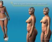 Are you looking for the best surgeon to perform your liposuction procedure? Instantly &amp; Safely Get Rid Of Flabby Bellies, Dangling Underarms &amp; Thunder Thighs, Add more definition to your body.nFree Quote. Call Us..!nnnnnPlease visit my other cool channels here:nYoutube - this is where I upload some of my personal reviews and opinions about different type of surgical procedures that I think can be very invasive, and some that nnare goodnhttps://www.youtube.com/channel/UCdwS4SRgYvY1h_jYAAT