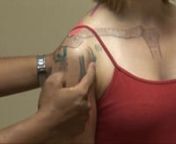 This is a step-by-step instructional video for shoulder examination. It is designed for medical students, residents and rheumatology fellows, but would also be beneficial to general practitioners and allied health professionals.