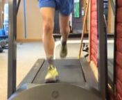 Training out a crossover gait?nnThis gal came to see us with right-sided hamstring insertional pain. During gait analysis we noted that she has a crossover gait as seen in the first two sections of this video. In addition to making other changes both biomechanically (manipulation, gluteus medius exercises) and in her running style (