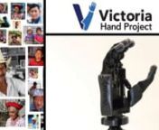 Overview of the Victoria Hand Project work in Guatemala and Nepal. The availability of prosthetic devices is extremely limited in developing countries, yet the demand there is the greatest. The Victoria Hand Project (VHP)is focused on providing amputees with access to a very low-cost, highly functional, customized, 3D printed upper-limb prosthesis.It&#39;s specifically designed for local production and distribution in the countries where it is needed. With our prosthetic device, amputees can regai