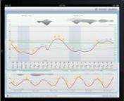 Are you interested in weather trends? Then this is the right application for you.nnMeteogram gives you graphical depictions of trends with variables such as temperature, atmospheric pressure, humidity, wind speed, percentage of cloud cover.nnThe main screen contains two graphs. The upper screen shows a detailed summary for the next 48 hours, and the lower screen shows a change in temperature for 6 days in advance.nThere is a special pop-up menu for easy usability. There is no need to follow the