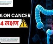 In this informative video Dr. Chintamani Godbole talks about the growing incidence of colon cancer in India.nnHe says, with the changing diet to fast food-oriented western diets, the incidence of colon cancer has now become a common phenomenon in India. However, if detected on time, colon cancer can be cured completely.nnIn this video, Dr. Godbole sheds light on the 4 signs and symptoms that can lead to colon cancer, namely change in bowel habits, blood in stools, iron deficiency anaemia, and un