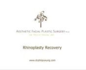 http://www.drphilipyoung.com/procedures/rhinoplasty/Dr Young Discusses the Rhinoplasty Recovery Process for you to learn more about the post procedure period and what it entails through the video below. In this video of Dr. Young talking, he covers topics from: sleeping upright; cleaning your incisions; how to ice; using Afrin sprays / nasal irrigations; when to exercise; how long it takes to heal; etc.