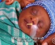 Inserting a Nasogastric Tube (Bangla) - Small Baby Series from bangla baby