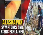 Discover all you need to know about Alaskapox, an unusual virus causing concern in Alaska. From its origins to how it spreads and its symptoms, join us as we unravel the mysteries surrounding this unique viral threat. &#60;br/&#62; &#60;br/&#62;#AlaskaPox #Alaska #AlaskaPoxSymptoms #AlaskaPoxVirus #ALaskaPoxDisease #AlaskaNews #HealthCare #AlaskaPeople #Oneindia&#60;br/&#62;~PR.274~ED.155~