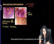 Skin pathology from dimple games mp3 song skin